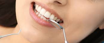 Вестибулопластика в стоматологии — что это и зачем необходима?